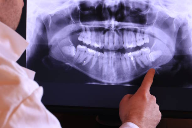 Best Emergency Treatment for Toothache in Laurens, IA